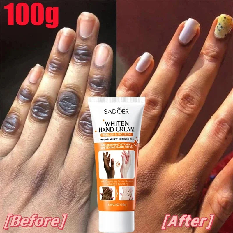 2024 Dark Knuckles Fast Whitening Serum Anti Cracking Cream Pigmentation