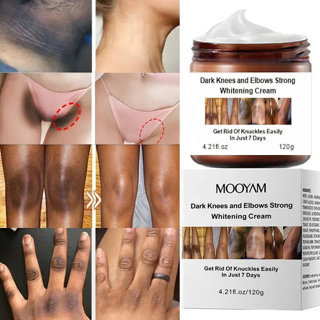 Niacinamide Dark Knees Knuckles Elbows Armpit Whitening Cream,Woman Private Parts Cream for Dark Skin