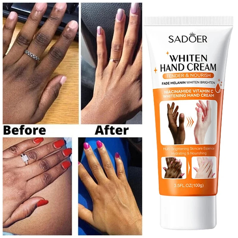 2024 Dark Knuckles Fast Whitening Serum Anti Cracking Cream Pigmentation