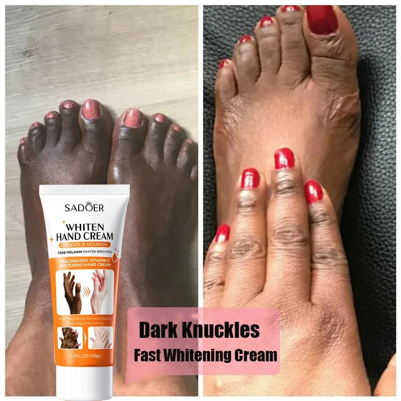 2024 Dark Knuckles Fast Whitening Serum Anti Cracking Cream Pigmentation