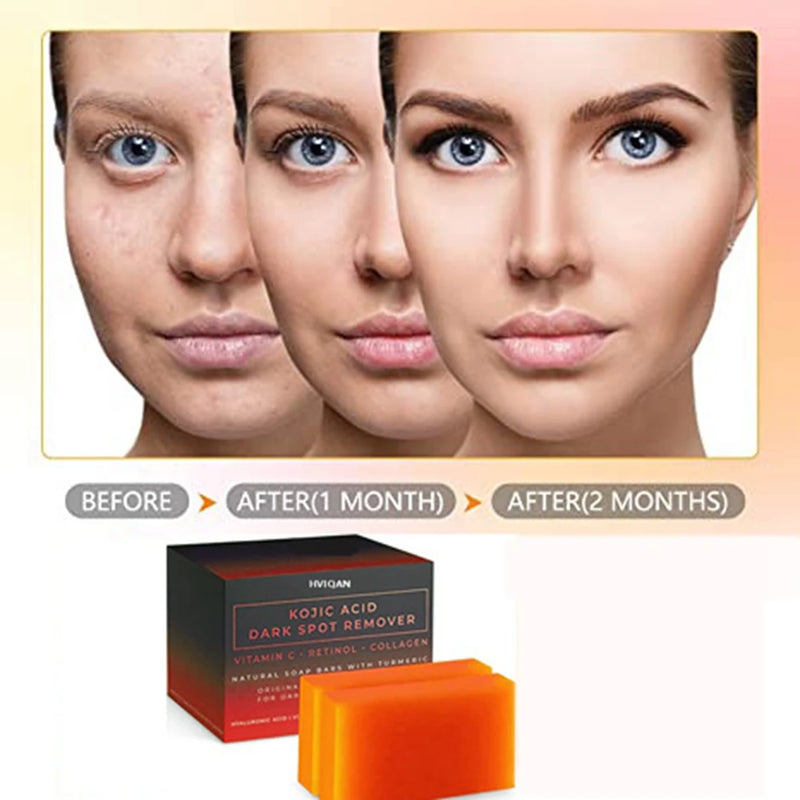 Kojic Acid Soap Vitamin C Soap Handmade Whitening Soap Skin